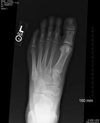 Benefits of EHR for Podiatry